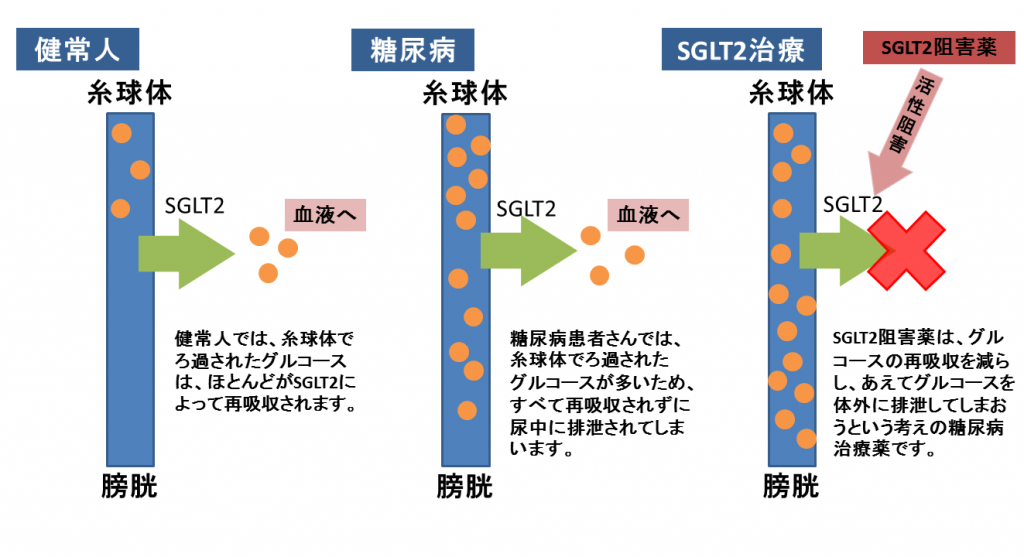 SGLT2阻害薬の作用機序について
